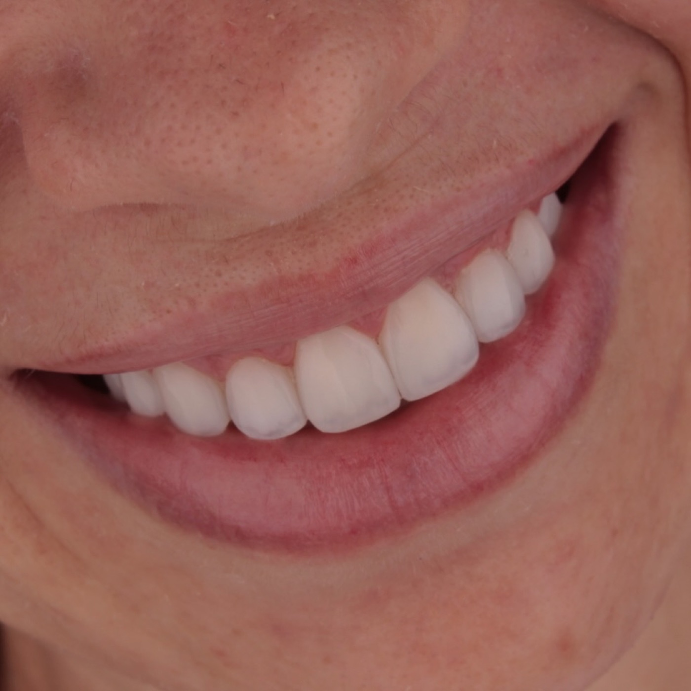 Sorriso harmônico