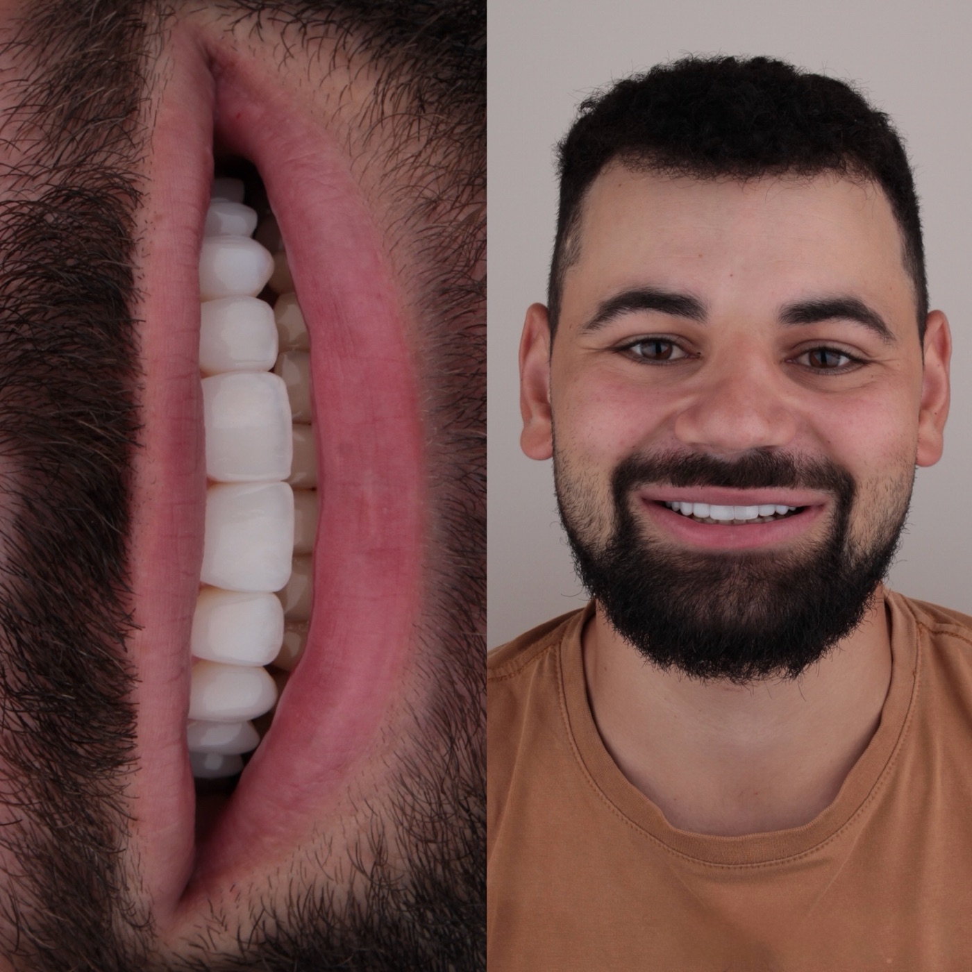 Paciente sorrindo