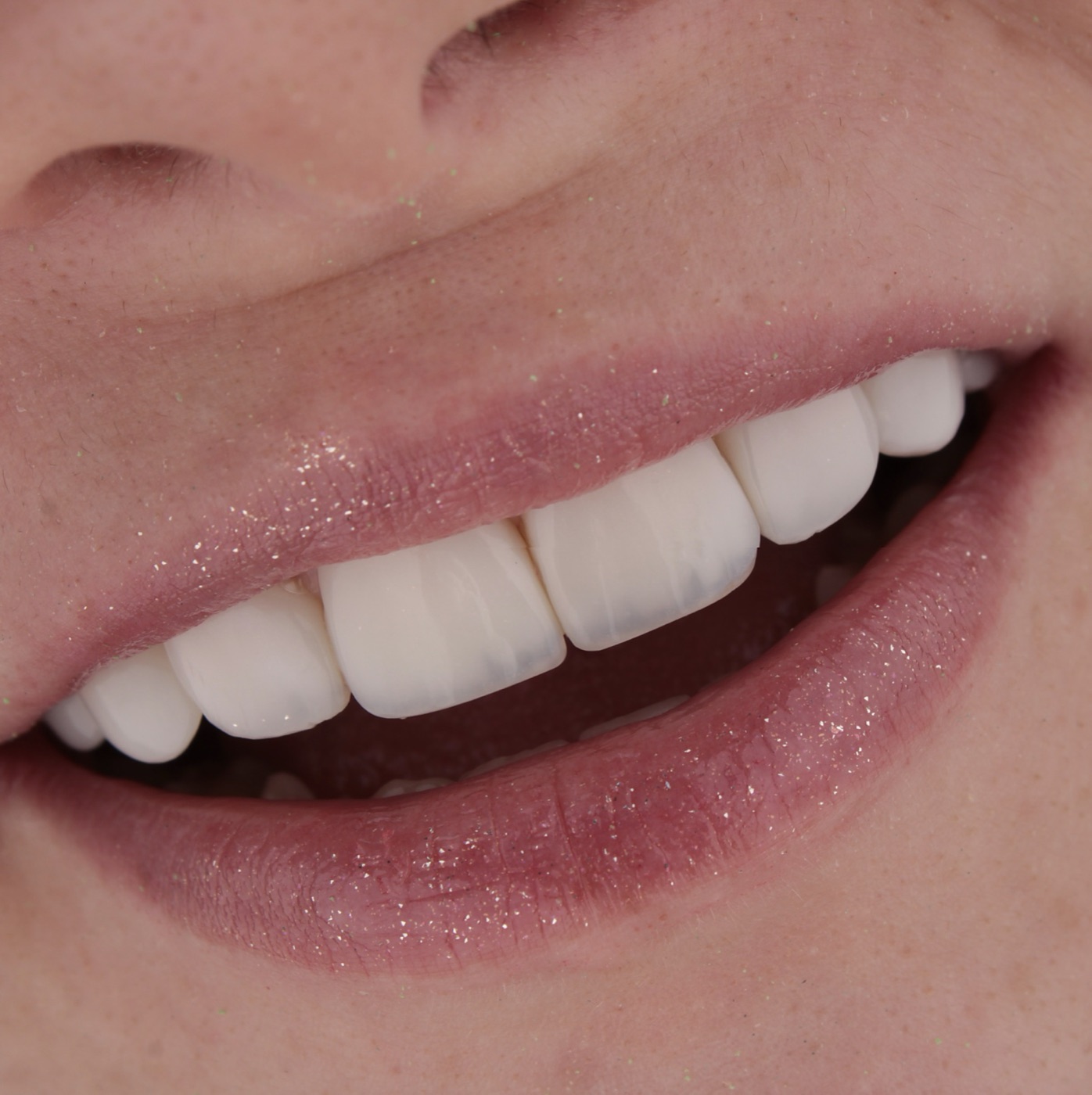 Sorriso em perfil