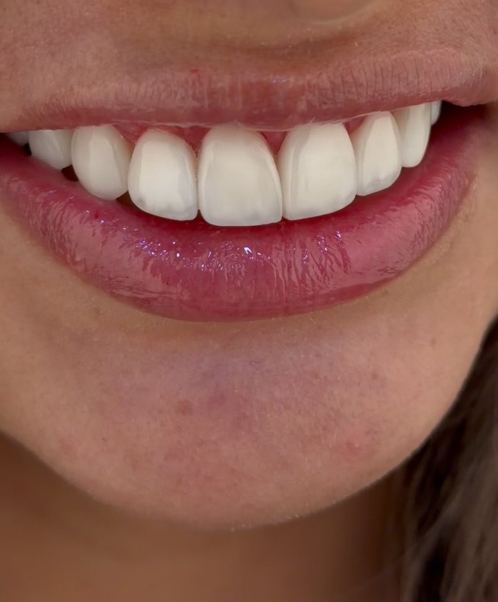 Sorriso